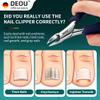 DEOU Podiatrist Toenail Clippers Ingrown Toenail Tools for Thick Nails and Inlaid Nails,Manicure and Pedicure Clippers,Heavy Duty Nail Clippers, Pedicure Tools (Dark Blue+Nail Remover) view 2