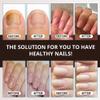 Abera Combo Premium Nail Restoration Drops - Nourishing Support for Weak, Stained & Deformed Nails - Supports Healthy Nails with Quick-Drying Formula for Fingernails and Toenails view 3
