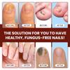 Abera Maximum Strength Nail Repair Serum - Intensive Care for Damaged and Hardened Nails - Supports Healthy Nails with Quick-Drying Formula for Fingernails and Toenails (Red) view 4