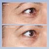 Perricone MD High Potency Triple Retinol Renewal Eye Serum, 0.5 fl. oz. view 4