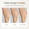 FELOOW IPL Hair Removal for Women: Permanent Hair Reduction in 3 Weeks view 3