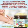 Botanical Beauty KOKUM BUTTER 100% Pure Natural REFINED Cold-Pressed for Face, Skin, Body, Hair, Lip, Nails. Rich in Vitamin E. Beauty Moisturizing Nourishing Butter Rich in Vitamin E (8 Fl Oz) view 3