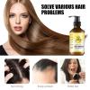 Ginger Hair Shampoo, Natural Ginger Anti-Dandruff Shampoo for Anti Hair Loss Cleansing Moisturizing Control Frizz for Strengthening Hair for All Hair Types, Men and Women Travel Size - 3.38 fl oz view 4