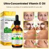 Vitamin E Oil Blend 75,000 IU, Pure Vitamin E Oil for Skin, Scars, Nails and Scalp, Face and Body Moisturizer, Hydrating Dry Skin, Reduce Stretch Marks, Fine Lines & Wrinkles, 2Fl Oz (Pack of 2) view 2