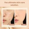 2 in 1- Luxury Anti-Wrinkle Foudation Stick, Korea Flawless Eraser Foundation Stick, Double Head Foundation Make-Up Stick, Multi-use Foundation Stick Makeup with Brush (White*2, 20g) view 4