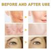 2PCS GOCAYRRY Advanced Snail Mucin 96% Power Repairing Essence, Snail Mucin 96% - Anti-Aging Serum, With Snail Secretion Filtrate For Dull (02) view 2
