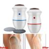 HIONJIN Electric Foot Grinder Pedicure Tools Callus Remover Foot Care Tool Remover Absorbing Machine Dead Skin Foot Polisher Trimmer(D) view 4