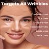 Akissos Anti Wrinkle Patches 160PCS Update Version Full Facial Forehead Wrinkle Patches, Face Tape for Wrinkles Overnight to Smooth Lift Forehead Eyebrow Frown 11 Eye Crow's Feet Smile Lines Lip view 4