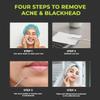 2 Pcs Pimple Extractor Tool Surgical Stainless Steel 410 | Comedone Extractor, Pimple Popper, Blackhead Remover for Face, Zit Popper, Pimple Needle for Acne Removal view 2