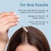 BYEOAN Eoans Leave-In Scalp Serum  Dry Scalp Relief, Anti-Dandruff & Itchy Scalp Treatment with Rosemary, Sage, Biotin & Amino Acids  Vegan, Hydrating Clean Formula, 1 fl oz (30 mL) view 4