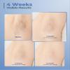 Laser Hair Removal for Women and Men, At-Home IPL Hair Removal with 999,900 Flashes, 3 Modes & Auto Flashing for Fast Full Body, Hair Removel for Facial Legs Arms Bikini Line view 3