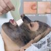 Facial Skin Scraper Tool - Face Cleansing Spatula for Deep Pore Cleaning, Manual Skin Scraper for Nose, Cheeks, Forehead, and Chin | Metal Blackhead Extractor, Ideal giftt for Men & Women view 2