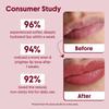 Beetroot Tinted Lip Balm With SPF 50 PA+++ & Kojic Acid - Ceramide & Peptide - Lip Brightening & Hydrating - SLS & Paraben Free 5 gm view 4