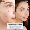 Sporty Acne Patches  Hydrocolloid Spot Cover for Zits, Pimples & Blemishes, Fast-Acting Formula, Long-Lasting & Gentle on Skin. (36 Count) view 3