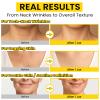 Chillihaer 8-in-1 Radiant Neck Firming Cream, Tighten and Lift Neck Wrinkle Cream, Collagen Retinol Face and Chest Firming Tightening for Women and Men with Sagging Crepey Skin Over 50 & 60 view 3