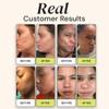 Gleamin Brightening Duo  Vitamin C Clay Mask & Advanced Brightening Moisturizer for Dark Spots, Uneven Tone & Glowing Skin view 3