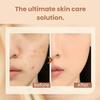 2PCS 2 in 1- Luxury Anti-Wrinkle Foudation Stick, 2025 Instant Concealing Foundation Stick with Built-in Brush (2PCS) view 4