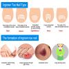 Ejoyous Ingrown Nails Correction Wire Kit, 12Pcs Toenail Correction Tool, 6 Sizes Ingrown Wire Fixer, Ingrown Toenail Removal Kit, Foot Care view 3