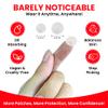 Acne & Pimple Patches  Profeccional Hydrocolloid Acne Patches for Fast Blemish & Zit Removal | Pimple Spot Treatment for Face & Skin | Vegan, Cruelty-Free | 180 Count view 2