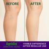 Agridin Horse Chestnut Cream for Legs & Body  Varicose Veins Relief, Anti-Swelling, Circulation Support  Enriched with Rosemary & Orange Oils  150ml / 5.07 fl oz view 4