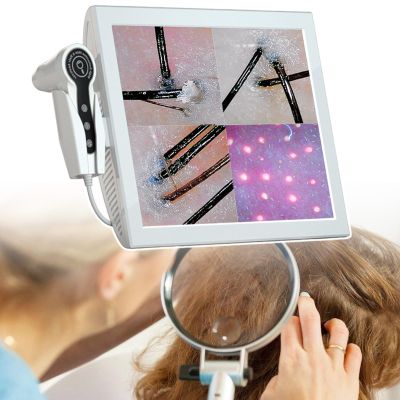 HCAUYNN Trispectrum Skin Hair Scalp Detector Hair,15 Inch Hd LCD Quad Screen Switching,200X Hd Lens and 50X Tri Spectral Lens,for Home Scalp Care,110V