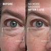 Dr. Brandt Needles No More, No More Baggage - 0.23 oz, Pack of 2 - Minimizes Under-Eye Bags, Puffiness & Dark Circles view 4