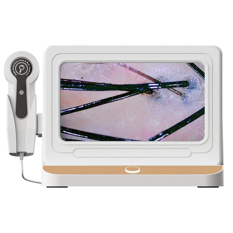 Elitzia Skin Hair Analyzer 10 Inch LCD Screen Digital 50X/200X Lens HD Scalp Detector Skin Hair Magnifier Analyzer Professional Hair Skin Freeze Frame Analysis Scanner Hair Follicle Detector ETDA10