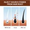 300ml Anti Hair Loss Shampoo,Anti-Hair Fall Promote Hair Growth,Rich in Various Plant Extracts,Volumizing and Moisturizing For All Types (2pc) view 4