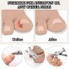 Ingrown Toenail Removal Tool Toenail, Stainless Steel Ingrown Nail Clipper, Very Sharp Straight Nail Clipper with Ergonomically Designed Long Handle view 2
