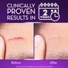 Cicatricure Advanced Scar Gel for Face & Body - Proven Results in 2 Weeks, Scar Treatment for Surgical Scars, Stretch Marks, Scars of Burns and Injuries, Acne Scar Treatment, 2 oz (56g) view 3