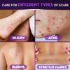 Cicatricure Advanced Scar Gel for Face & Body - Proven Results in 2 Weeks, Scar Treatment for Surgical Scars, Stretch Marks, Scars of Burns and Injuries, Acne Scar Treatment, 2 oz (56g) view 4