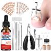 Ingrown Toenail Removal Kit, Ingrown Toenail Tool Kit with Ingrown Toenail Corrector, Ingrown Toenail Drops, Corrector Patch, Toenail Clipper, Nail File Lifter Tools view 1