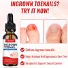 Ingrown Toenail Removal Kit, Ingrown Toenail Tool Kit with Ingrown Toenail Corrector, Ingrown Toenail Drops, Corrector Patch, Toenail Clipper, Nail File Lifter Tools view 2