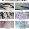 DJCDDM Skin Diagnosis Hair Analyzer Machine, 11inch Skin Scalp Detector, Multifunctional Scalp Detector Machine with 50X/200X Skin Magnifier view 2