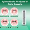 Titanium Alloy Ingrown Toenail Corrector New Version Ingrown Toenail Removal Tool Kit, Designed for Curved Nail Repair Big Toe Ingrown Toenail view 3