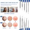 6 Pcs Blackhead Remover Tools,Blackhead Extractor,Pimple Popper Tool Kit for Blackhead, Whitehead, Acne, Zit, Comdone, Pores, Fat Granules, Blemishs on Nose, Face & Ear view 3