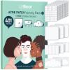 LitBear Large Pimple Patches for Face (6 Sizes 401 Counts), Big Hydrocolloid Acne Patches, XL Hydrocolloid Bandages for Body, Cheek, Forehead, Chin, Full Face, Back, Nose view 1