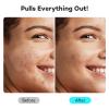 LitBear Large Pimple Patches for Face (6 Sizes 401 Counts), Big Hydrocolloid Acne Patches, XL Hydrocolloid Bandages for Body, Cheek, Forehead, Chin, Full Face, Back, Nose view 4