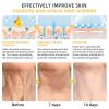 All Body Skin Treatment Cream, Bee Venom Skin Treatment Cream, Bee Venom All-in-One Cream-50g, for All Skin Types (2 Bottle) view 4