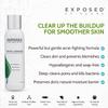 Exposed Skin Care Acne Facial Cleanser + Activated Charcoal Face Mask Bundle for Acne Prone Skin - Pore Clarifying Acne Treatment for All Ages, Skin Types view 4