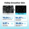 BE THE SKIN BHA+ 30-Second Exfoliator - Gommage Peeling Gel Willow Bark BHA + AHA Melts & Sweeps Dead Skin, Helps Clear Pores & Blackheads, No Harsh Beads for Oily Blemish-Prone Skin | 3.38 fl oz view 4