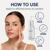 AD SOLUTION Ato Fast Calming Serum for Sensitive & Eczema-Prone Skin Instant Relief from Itch, Redness & Flare-Ups Powered by Cica & Panthenol 1.69 Fl Oz view 4