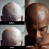 Scalp Oil Essential Oil for Bald Heads with Tea Tree & Manuka Oil - 1 oz view 4