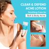 AOBBIY Butt Acne Clearing Treatment Cream: Clears & Prevents Breakouts  Gentle Body & Back Treatment for Clogged Pores, Folliculitis & Bumps view 2