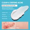 AOBBIY Butt Acne Clearing Treatment Cream: Clears & Prevents Breakouts  Gentle Body & Back Treatment for Clogged Pores, Folliculitis & Bumps view 3