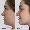 SickScience ShapeShift Advanced Jaw & Neck Firming Serum - Double Chin Reducer, Face Tightening Treatment with Exosome Technology to Lift Sagging Skin & Wrinkles in both Women & Men, 1.7oz view 3