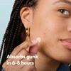 Mighty Patch Invisible+ Patch  The Barely-There Daytime Hydrocolloid Acne Pimple Patch for Covering Zits and Blemishes, Tapered Edges Designed to Blend Into Skin (72ct) view 4
