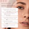 Zing Prime Clear Hydrocolloid Pimple Patches for Face, Acne Dots & Zit Stickers, Strong Adhesion Blemish Patch, Made in Korea, Vegan (45 Count) view 3