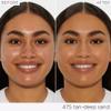 tarte maracuja creaseless full-coverage concealer  Waterproof Longwear with Vitamin C to Hydrate look of Dark Circles, Blemishes & Discoloration, Vegan & Cruelty Free view 2