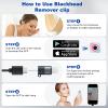 Kosimai Black Head Remover for Face Tool Professional Pimple Popper HD Camera,30 Times Magnification 1080P, (Silver) view 4